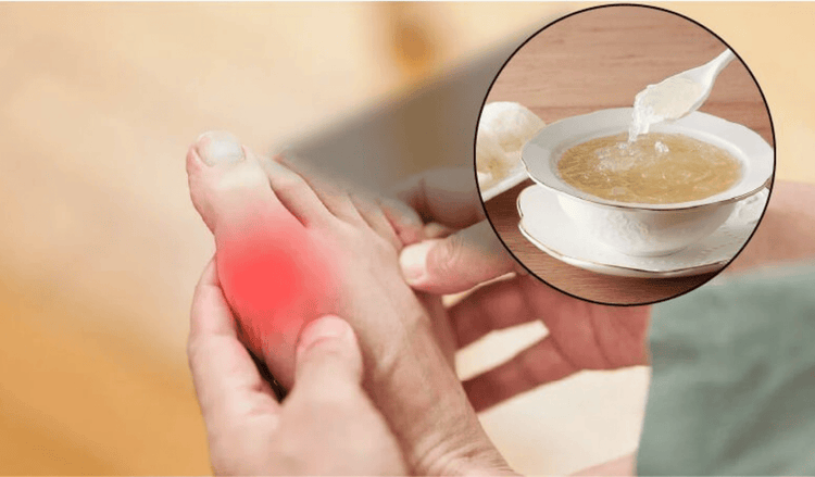 Bị Gout ăn yến được không, cần lưu ý những gì?