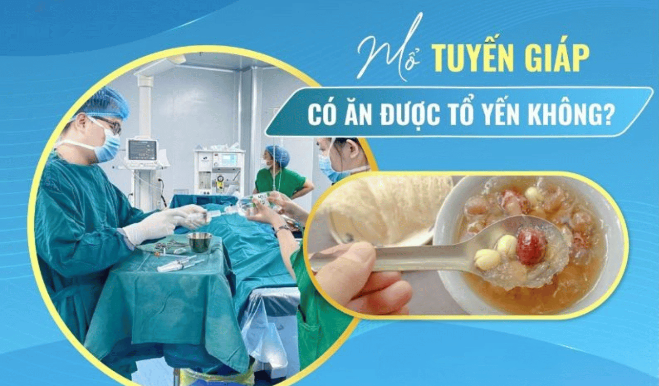 Mổ tuyến giáp có ăn được tổ yến không, Cần lưu ý gì?