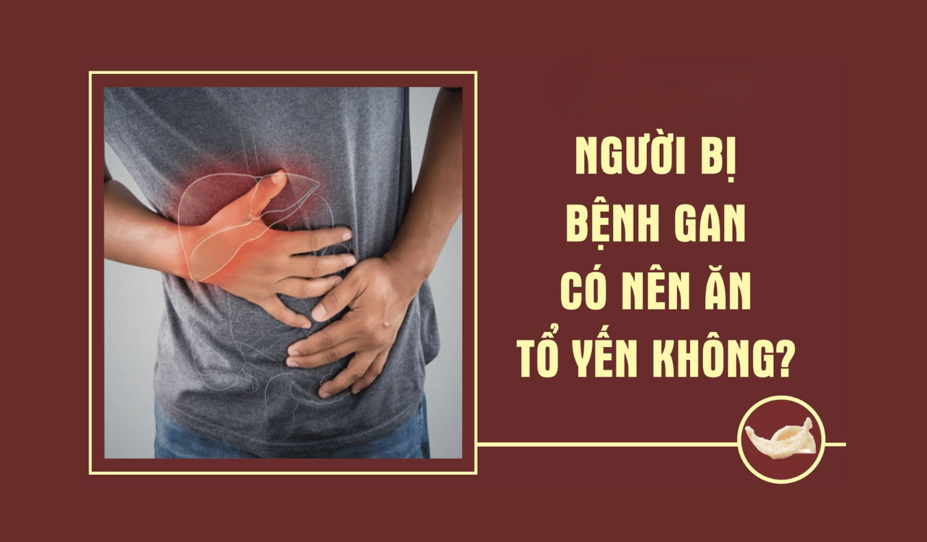 Người bệnh gan có nên ăn tổ yến hay không, Cần lưu ý gì?