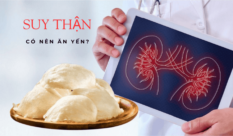Bệnh suy thận có ăn được tổ yến không, Cần lưu ý gì?